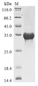 Greater than 85% as determined by SDS-PAGE.Recombinant Human Spry Domain-Containing Socs Box Protein 1 (SPSB1) Protein (His)