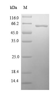Greater than 90% as determined by SDS-PAGE.Recombinant Human Paraneoplastic Antigen-Like Protein 5 (PNMA5) Protein (His-SUMO)
