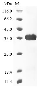 Greater than 85% as determined by SDS-PAGE.Recombinant Dog Troponin I, Cardiac Muscle (TNNI3) Protein (His&Myc)