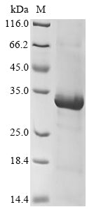 Greater than 85% as determined by SDS-PAGE.Recombinant Human Killer Cell Immunoglobulin-Like Receptor 2Dl5A (KIR2DL5A) Protein (His&Myc)