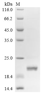 Greater than 90% as determined by SDS-PAGE.Recombinant Human Prominin-2 (PROM2) Protein (His-SUMO)