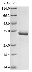 Greater than 90% as determined by SDS-PAGE.Recombinant Human Killer Cell Immunoglobulin-Like Receptor 2Dl5B (KIR2DL5B) Protein (His&Myc)