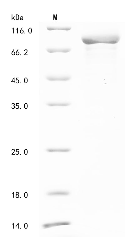 Greater than 85% as determined by SDS-PAGE.Recombinant Mouse 1-Phosphatidylinositol 4,5-Bisphosphate Phosphodiesterase Delta-1 (PLCD1) Protein (His&Myc)