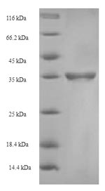 Greater than 90% as determined by SDS-PAGE.Recombinant Human C-Type Lectin Domain Family 4 Member C (CLEC4C) Protein (His-SUMO), Active