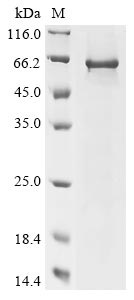 Greater than 85% as determined by SDS-PAGE.Recombinant Human Charged Multivesicular Body Protein 7 (CHMP7) Protein (His)