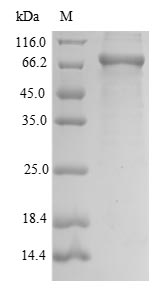 Greater than 90% as determined by SDS-PAGE.Recombinant Mouse Mannan-Binding Lectin Serine Protease 2 (MASP2) Protein (His)