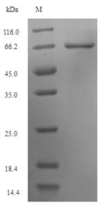 Greater than 90% as determined by SDS-PAGE.Recombinant Human Keratin, Type I Cuticular Ha5 (KRT35) Protein (His-SUMO)