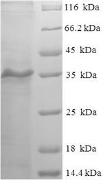 Greater than 90% as determined by SDS-PAGE.