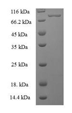 Greater than 90% as determined by SDS-PAGE.Recombinant Human Bifunctional Polynucleotide Phosphatase/Kinase (PNKP) Protein (His-SUMO)