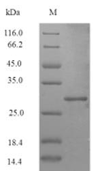 Greater than 90% as determined by SDS-PAGE.Recombinant Staphylococcus Aureus Atp-Dependent Clp Protease Atp-Binding Subunit Clpc (CLPC) Protein (His-SUMO)
