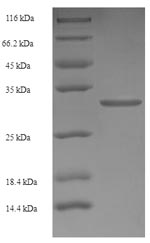 Greater than 90% as determined by SDS-PAGE.Recombinant Human Retinoic Acid Receptor Responder Protein 2 (RARRES2) Protein (His-SUMO)