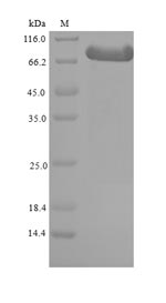 Greater than 90% as determined by SDS-PAGE.Recombinant Mouse Beta-Adrenergic Receptor Kinase 1 (GRK2) Protein (His-SUMO)