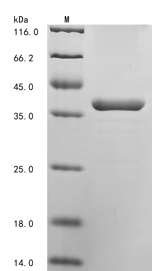 Greater than 90% as determined by SDS-PAGE.Recombinant Rat Transferrin Receptor Protein 1 (TFRC) Protein (His-SUMO)