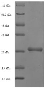 Greater than 90% as determined by SDS-PAGE.Recombinant Staphylococcus Aureus Staphylococcal Complement Inhibitor (SCN) Protein (His-SUMO)