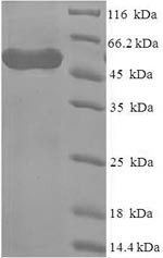 Greater than 90% as determined by SDS-PAGE.Recombinant Human Methylosome Protein 50 (WDR77) Protein (His-SUMO)