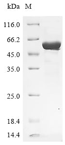 Greater than 90% as determined by SDS-PAGE.Recombinant Human Selenide, Water Dikinase 2 (SEPHS2) Protein (His&Myc)