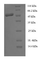 Greater than 90% as determined by SDS-PAGE.Recombinant Staphylococcus Aureus Staphopain B (SSPB) Protein (GST)