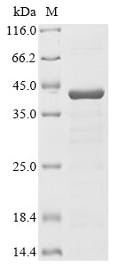 Greater than 85% as determined by SDS-PAGE.Recombinant Human Ataxin-2 (ATXN2) Protein (His)