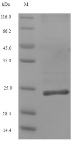 Greater than 90% as determined by SDS-PAGE.Recombinant Human Collagen alpha-1 (COL12A1) Protein (His)
