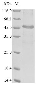 Greater than 85% as determined by SDS-PAGE.Recombinant Human O-Acetyl-Adp-Ribose Deacetylase Macrod1 (MACROD1) Protein (His)