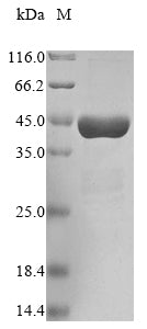 Greater than 90% as determined by SDS-PAGE.Recombinant Human Parkinson Disease Protein 7 (PARK7)