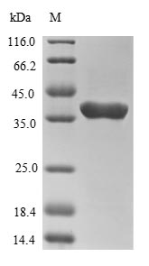 Greater than 85% as determined by SDS-PAGE.Recombinant Human Tumor Susceptibility Gene 101 Protein (TSG101) Protein (His-SUMO&Myc)