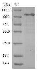 Greater than 90% as determined by SDS-PAGE.Recombinant Human Aminoacylase-1 (ACY1) Protein (GST)