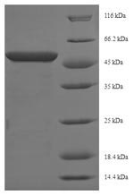 Greater than 90% as determined by SDS-PAGE.Recombinant Mouse Phosphoserine Aminotransferase (PSAT1) Protein (His-SUMO)