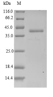 Greater than 90% as determined by SDS-PAGE.Recombinant Human Actin-Related Protein 2/3 Complex Subunit 5-Like Protein (ARPC5) Protein (GST)