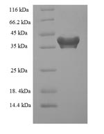 Greater than 90% as determined by SDS-PAGE.Recombinant Human Programmed Cell Death Protein 10 (PDCD10) Protein (His-SUMO)