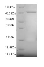 Greater than 90% as determined by SDS-PAGE.Recombinant Human Cytoplasmic Domain Polyadenylation Element-Binding Protein 1 (CPEB1) Protein (His-SUMO)