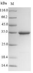 Greater than 90% as determined by SDS-PAGE.Recombinant Mouse Collectrin (CLTRN) Protein (His-SUMO&Myc)