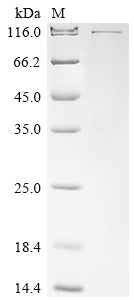 Greater than 90% as determined by SDS-PAGE.Recombinant Human Helicase Mov-10 (MOV10) Protein (His)