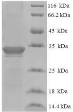 Greater than 90% as determined by SDS-PAGE.Recombinant Human Dysbindin Domain-Containing Protein 2 (DBNDD2) Protein (His-SUMO)