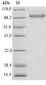 Greater than 85% as determined by SDS-PAGE.Recombinant Human Plasma Alpha-L-Fucosidase (FUCA2) Protein (GST)