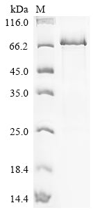 Greater than 90% as determined by SDS-PAGE.Recombinant Human Hydroperoxide Isomerase Aloxe3 (ALOXE3) Protein (His)