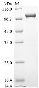 Greater than 90% as determined by SDS-PAGE.Recombinant Mouse Heat Shock Protein 75 Kda, Mitochondrial (TRAP1) Protein (His&Myc)