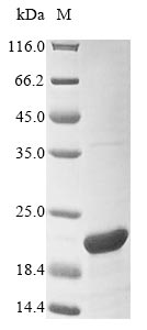 Greater than 85% as determined by SDS-PAGE.Recombinant Mouse 5-Hydroxyisourate Hydrolase (URAH) Protein (His&Myc)