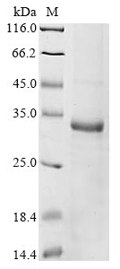 Greater than 85% as determined by SDS-PAGE.Recombinant Human Ras-Related Protein Rab-33B (RAB33B) Protein (His)