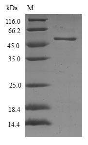 Greater than 90% as determined by SDS-PAGE.Recombinant Human Ras-Related Protein Rab-17 (RAB17) Protein (GST)