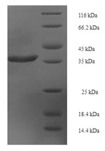 Greater than 90% as determined by SDS-PAGE.Recombinant Human Rab-Like Protein 5 (IFT22) Protein (His-SUMO)