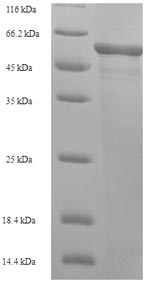 Greater than 90% as determined by SDS-PAGE.Recombinant Human L-2-Hydroxyglutarate Dehydrogenase, Mitochondrial (L2HGDH) Protein (His-SUMO)