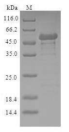 Greater than 90% as determined by SDS-PAGE.Recombinant Human Nicotinamide Mononucleotide Adenylyltransferase 1 (NMNAT1) Protein (GST)