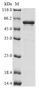 Greater than 85% as determined by SDS-PAGE.Recombinant Human Chromobox Protein Homolog 8 (CBX8) Protein (His&Myc)