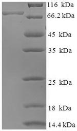 Greater than 90% as determined by SDS-PAGE.Recombinant Mouse Bag Family Molecular Chaperone Regulator 3 (BAG3) Protein (His-SUMO)