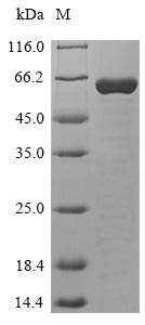Greater than 85% as determined by SDS-PAGE.Recombinant Human Histone Parylation Factor 1 (HPF1) Protein (His-SUMO&Myc)