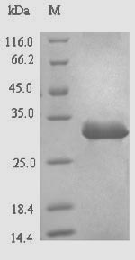 Greater than 90% as determined by SDS-PAGE.Recombinant Hepatitis B Virus Genotype D Subtype Ayw Protein X (X) Protein (His-SUMO)