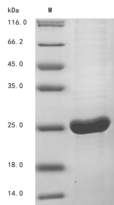 Greater than 85% as determined by SDS-PAGE.Recombinant Hepatitis B Virus Genotype D Subtype Ayw Protein X (X) Protein (His)