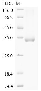 Greater than 85% as determined by SDS-PAGE.Recombinant Mouse Collagen alpha-3 (COL4A3) Protein (His&Myc)