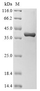 Greater than 85% as determined by SDS-PAGE.Recombinant Mouse Non-Receptor Tyrosine-Protein Kinase Tyk2 (TYK2) Protein (His&Myc)